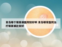 青岛哪个银屑病医院较好啊 青岛哪家医院治疗银屑病比较好