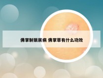 佛掌制银屑病 佛掌草有什么功效