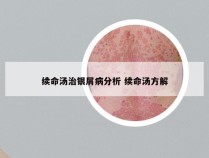 续命汤治银屑病分析 续命汤方解