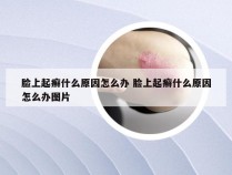 脸上起癣什么原因怎么办 脸上起癣什么原因怎么办图片