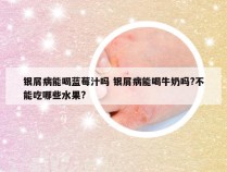 银屑病能喝蓝莓汁吗 银屑病能喝牛奶吗?不能吃哪些水果?