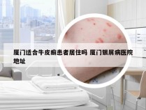 厦门适合牛皮癣患者居住吗 厦门银屑病医院地址