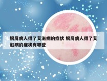 银屑病人得了艾滋病的症状 银屑病人得了艾滋病的症状有哪些