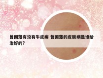 曾国藩有没有牛皮癣 曾国藩的皮肤病是谁给治好的?
