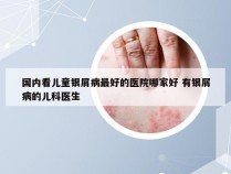 国内看儿童银屑病最好的医院哪家好 有银屑病的儿科医生