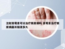 注射青霉素可以治疗银屑病吗 青霉素治疗银屑病最长输液多久