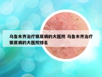 乌鲁木齐治疗银屑病的大医院 乌鲁木齐治疗银屑病的大医院排名