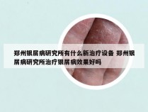 郑州银屑病研究所有什么新治疗设备 郑州银屑病研究所治疗银屑病效果好吗