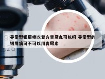 寻常型银屑病吃复方青黛丸可以吗 寻常型的银屑病可不可以用青霉素