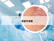 年轻牛皮癣