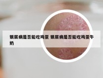 银屑病是否能吃鸡蛋 银屑病是否能吃鸡蛋牛奶