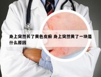 身上突然长了黄色皮癣 身上突然黄了一块是什么原因