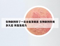 生物制剂停了一定会复发银屑 生物制剂停用多久后 恢复免疫力