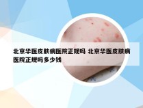 北京华医皮肤病医院正规吗 北京华医皮肤病医院正规吗多少钱