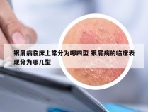 银屑病临床上常分为哪四型 银屑病的临床表现分为哪几型