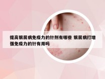 提高银屑病免疫力的针剂有哪些 银屑病打增强免疫力的针有用吗