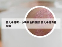 婴儿手臂有一小块白色的皮肤 婴儿手臂白色疙瘩
