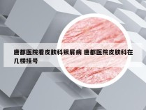 唐都医院看皮肤科银屑病 唐都医院皮肤科在几楼挂号