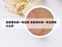 皮肤像长癣一样还痒 皮肤像长癣一样还痒用什么药