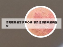 济南银屑病曾武军心细 谁去过济南银屑病医院