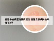 宿迁牛皮癣医院就找楚街 宿迁皮肤病防治所好不好?