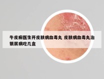 牛皮癣医生开皮肤病血毒丸 皮肤病血毒丸治银屑病吃几盒