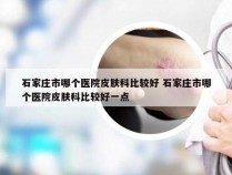 石家庄市哪个医院皮肤科比较好 石家庄市哪个医院皮肤科比较好一点