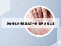 那些维生素对银屑病的作用 银屑病 维生素