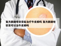 复方酮康唑软膏能治疗牛皮癣吗 复方酮康唑软膏可以治牛皮癣吗