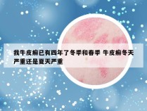 我牛皮癣已有四年了冬季和春季 牛皮癣冬天严重还是夏天严重