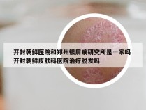 开封朝鲜医院和郑州银屑病研究所是一家吗 开封朝鲜皮肤科医院治疗脱发吗