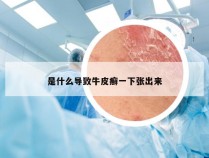 是什么导致牛皮癣一下张出来