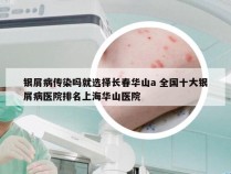 银屑病传染吗就选择长春华山a 全国十大银屑病医院排名上海华山医院