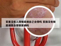 家里没有人得银屑病自己会得吗 家族没有银屑病我会得银屑病吗