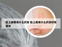 脸上癣要用什么药膏 脸上癣用什么药膏好得最快