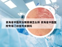 青海省中医院治银屑病怎么样 青海省中医医院专家门诊挂号皮肤科