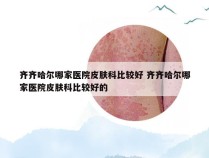 齐齐哈尔哪家医院皮肤科比较好 齐齐哈尔哪家医院皮肤科比较好的