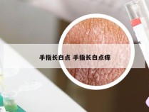 手指长白点 手指长白点痒