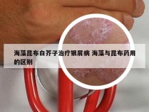海藻昆布白芥子治疗银屑病 海藻与昆布药用的区别