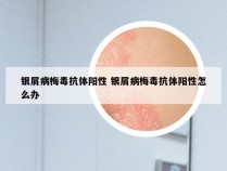 银屑病梅毒抗体阳性 银屑病梅毒抗体阳性怎么办