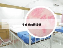 牛皮癣的情况吧