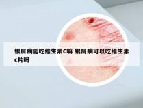 银屑病能吃维生素C嘛 银屑病可以吃维生素c片吗