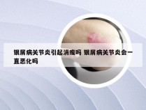 银屑病关节炎引起消瘦吗 银屑病关节炎会一直恶化吗