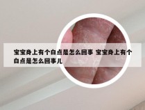 宝宝身上有个白点是怎么回事 宝宝身上有个白点是怎么回事儿