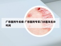 广慈医院牛皮癣 广慈医院专家门诊医生出诊时间