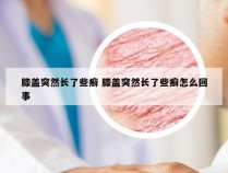 膝盖突然长了些癣 膝盖突然长了些癣怎么回事