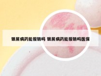 银屑病药能报销吗 银屑病药能报销吗医保
