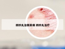 四妙丸治银屑病 四妙丸治疗