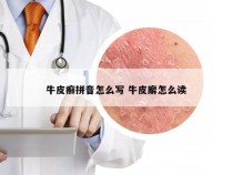 牛皮癣拼音怎么写 牛皮廨怎么读