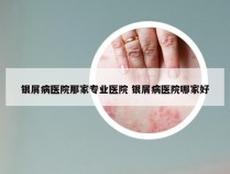 银屑病医院那家专业医院 银屑病医院哪家好
